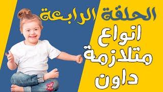 الحلقة الرابعة | انواع متلازمة داون