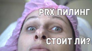 Действует ли PRX-T33 пилинг? Честный отзыв о процедуре, вся правда. Проверено на себе.