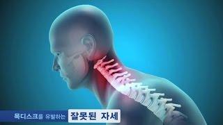 자생한방병원이 알려주는 목디스크 원인·증상·치료법