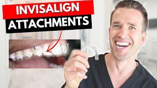 Don't get Invisalign Attachments Before watching this! | Dr. Nate