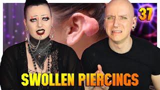 Reacting To Piercing Keloids & Hypertrophic Scars (ft.Toxic Tears) | Piercings Gone Wrong 37 | Roly