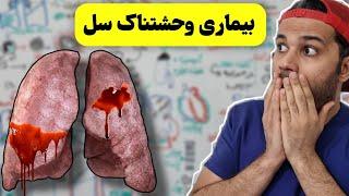 بیماری سل | علت | علایم | تشخیص | درمان | TB | Tuberculosis