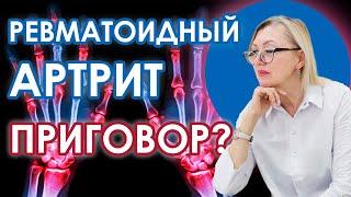 Ревматоидный артрит. Как справиться с болезнью?