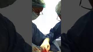 #doctors #surgery #operation  Злагоджена робота лікарів під час операції