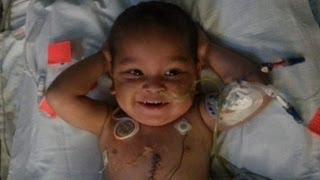 Three-Year-Old Adonis Ortiz Undergoes Five-Organ Transplant