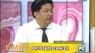 Understanding Prostate Cancer