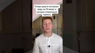 Что делать если получил ожог?