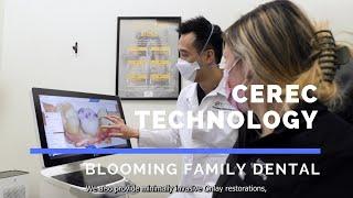 Introducing CEREC Same-Day Crowns