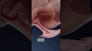 What is herpetic vaginitis and how does it affect the vagina? Explore gynecology in 3D with VOKA