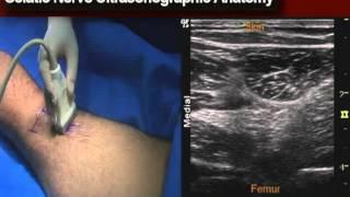 Ultrasonographic Anatomy- Sciatic Nerve