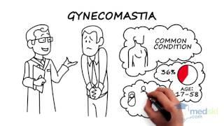 how to get rid of gynecomastia without surgery