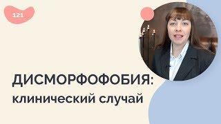 Дисморфофобия: клинический случай