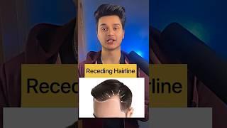 Best Hairstyle  for Receding Hairline     #recedinghairlineproblme #hairfall #hairthickening