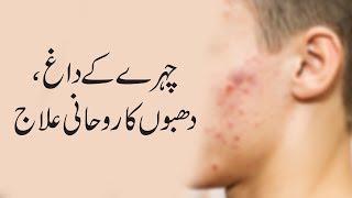 Chehre Ke Dagh Dhabbon Ka Rohani Ilaj - Islamic Spiritual Medicine - Pimples Freckles - Istikhara