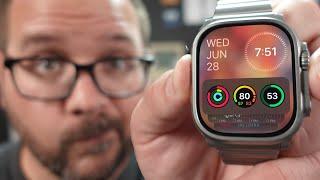 watchOS 10 Public Beta WATCH THIS Before Installing!