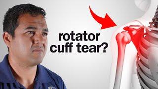 Can A Rotator Cuff Tear Heal Without Surgery?