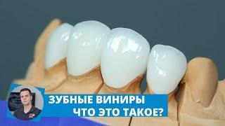 Зубные виниры что это такое?