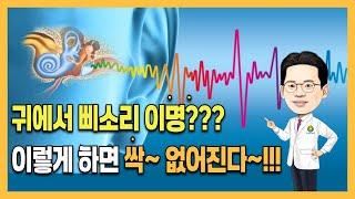 귀에서삐소리 이명증상 원인과 치료 도움되는 음식 주의사항