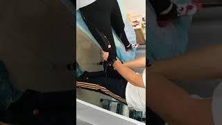 膝關節矯正手法關節鬆動術knee manipulation