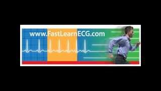 Master the basics of a normal 12 lead ECG or EKG (first workshop)