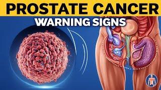 Early Warning Signs of Prostate Cancer