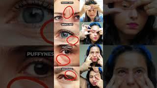 ️Antiaging glowingskinyoga reduce,forehead line, eye wrinkles,puffyeyes,droopy eyes try it#shorts