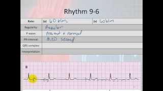 Basic Electrophysiology, part 6 - Sinus Node Rhythms