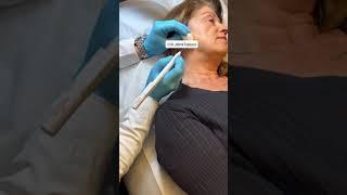 Dr. John Tedesco removes a benign lesion on the face