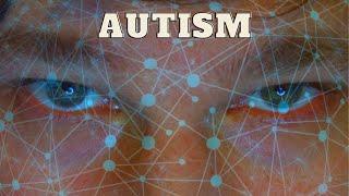 Autism Awareness: Living with Autism (by Bart) Part 1