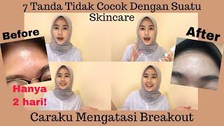 7 Tanda Tidak Cocok Dengan Produk Skincare + Cara Mengatasinya