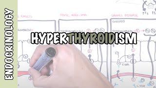 Hyperthyroidism Overview (causes, pathophysiology)