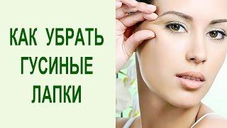 Уход за кожей вокруг глаз: как убрать отеки под глазами и гусиные лапки. Yogalife