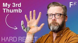 Bionic 3rd thumb: The future of human augmentation | Hard Reset