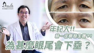 【林仲樞整形-美貌知尋識EP.26為什麼眼尾會下垂?】我還年輕怎麼會發生!!! #台北整形 #眼尾下垂