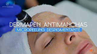 DERMAPEN ANTIMANCHAS MICROPEELING DESPIGMENTANTE l EP ESTETICA PROFESIONAL