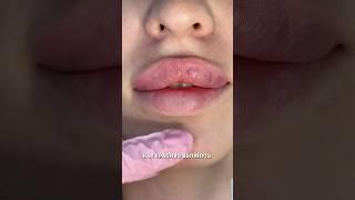 Как красиво вытянуть нижнюю губу?
