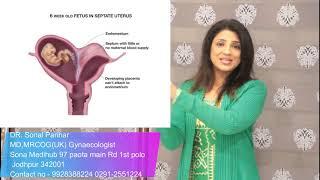 Bicornuate uterus , septate uterus & double uterus didelphus