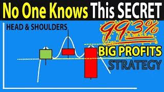  The Only "HEAD & SHOULDERS" Trading Strategy You Will Ever Need (5 Easy Steps To BIG PROFITS)