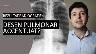 Ce înseamnă desen pulmonar accentuat pe radiografie?