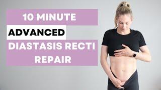 Diastasis Recti Repair Workout - ADVANCED - heal + strengthen your core postpartum