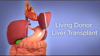 Medical Animation: Living Donor Liver Transplant | Cincinnati Children's