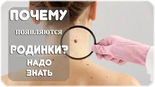 Почему появляются родинки?