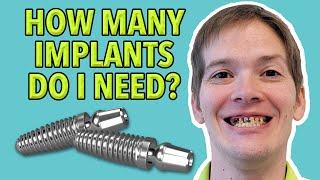 How Many Implants Should I Get?