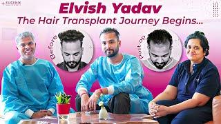 Unlocking Celebrity Hair Transplant Secrets: Elvish Yadav's Eugenix Experience