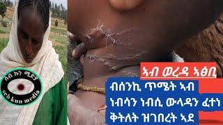 "ወደይ ቅጫ እናበለ ሞኽ ምስ ኣበለኒ ዘብልዖ ብምስኣነይ እየ ዓርሰ _ቅትለት ዝፈተንኩ" ትብል ነባሪት ወረዳ ኣፅቢ ዝኾነት ኣዶ።#master abnetkebede