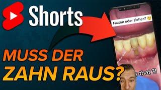 Zahn noch zu retten - ja oder nein? #shorts