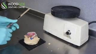 The Reline Process | Woodside Denture Centre