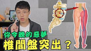 椎間盤為什麼會突出？一定要開刀才能解決嗎？