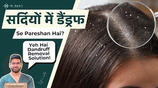 Dandruff Removal Treatment | Know How to Remove Dandruff in Winter by Best Dermatologist in Delhi