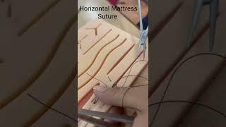 Demonstration of horizontal Mattress suturing technique.